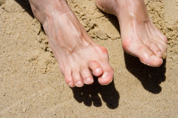 Most Common Feet Problems We Have