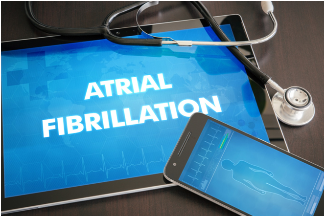What Are the Warning Signs of AFib? A Detailed Guide