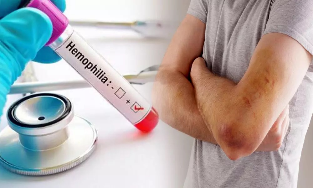 Haemophilia The Genetic Aspect of the Disease