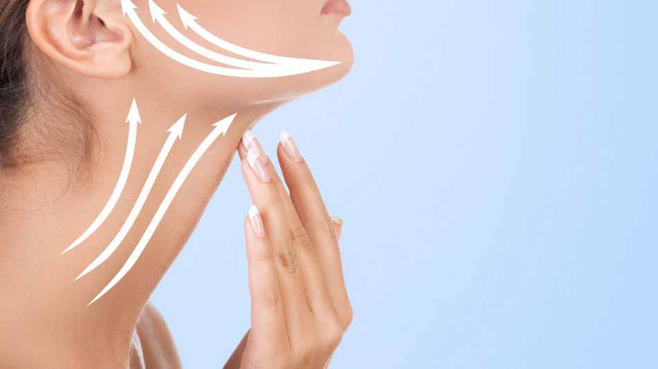 Neck Lift