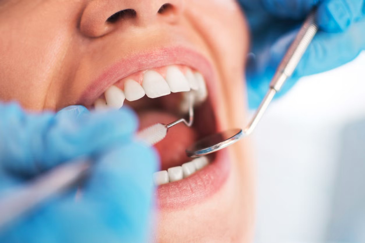 Choosing the Best Local Dental Services in Marion