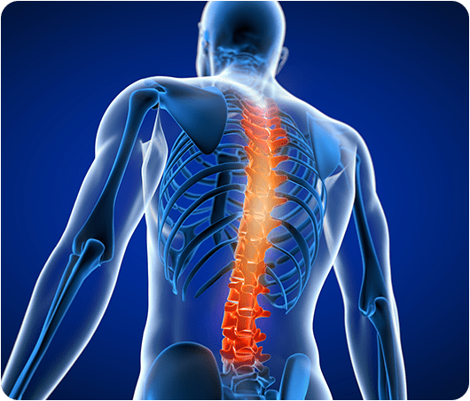 Back Pain Treatment: 5 Natural Ways Without Surgery