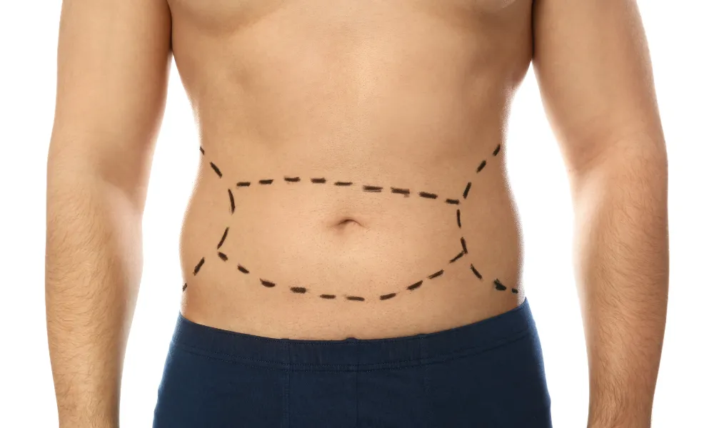 Tummy Tuck Prices