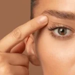Eyelid Surgery