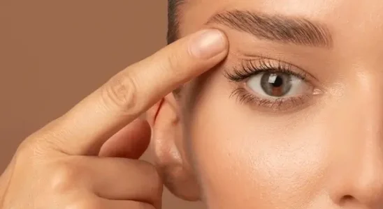 Eyelid Surgery