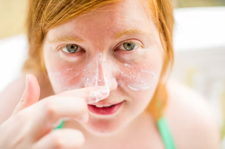 How is Melanotan I being investigated in modern dermatological studies?