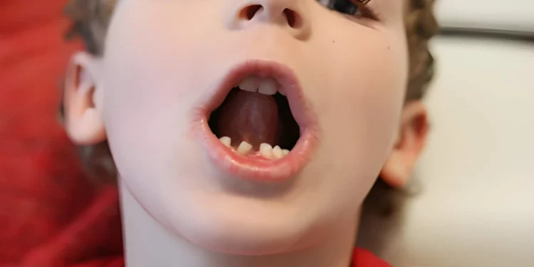 Signs Your Child May Need a Pulpotomy