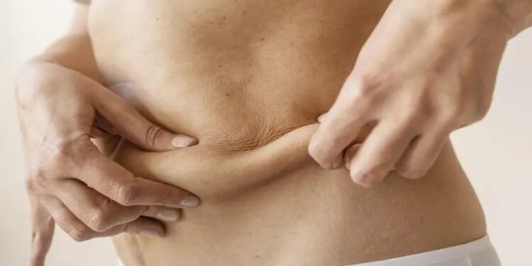 Effective Reverse Tummy Tuck Strategies Supporting Long Term Body Contour Refinement with Personalized Care