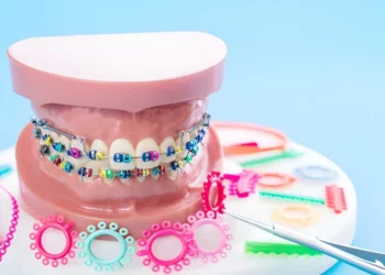 Which is Right for You – Damon Braces or Traditional Braces?