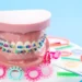 Which is Right for You – Damon Braces or Traditional Braces?